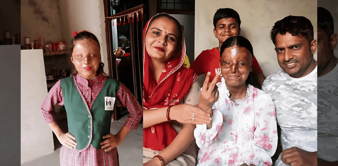 Kafi Acid Survivor