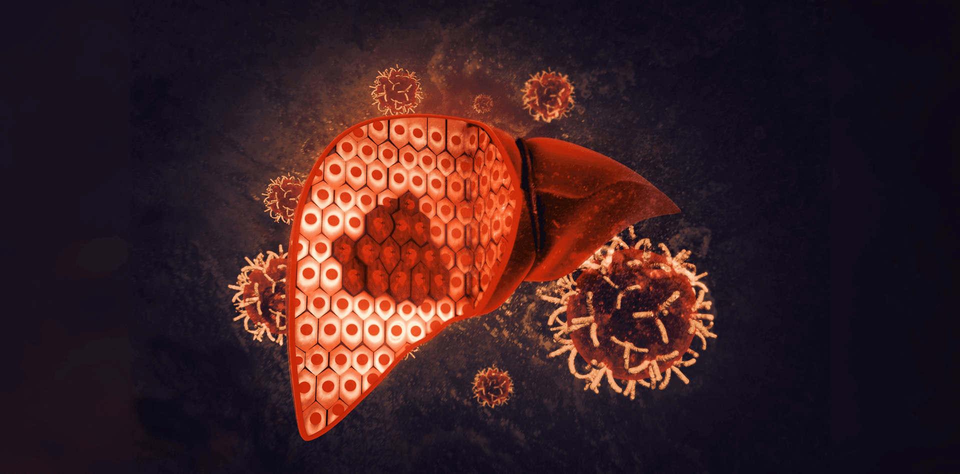 Fatty Liver