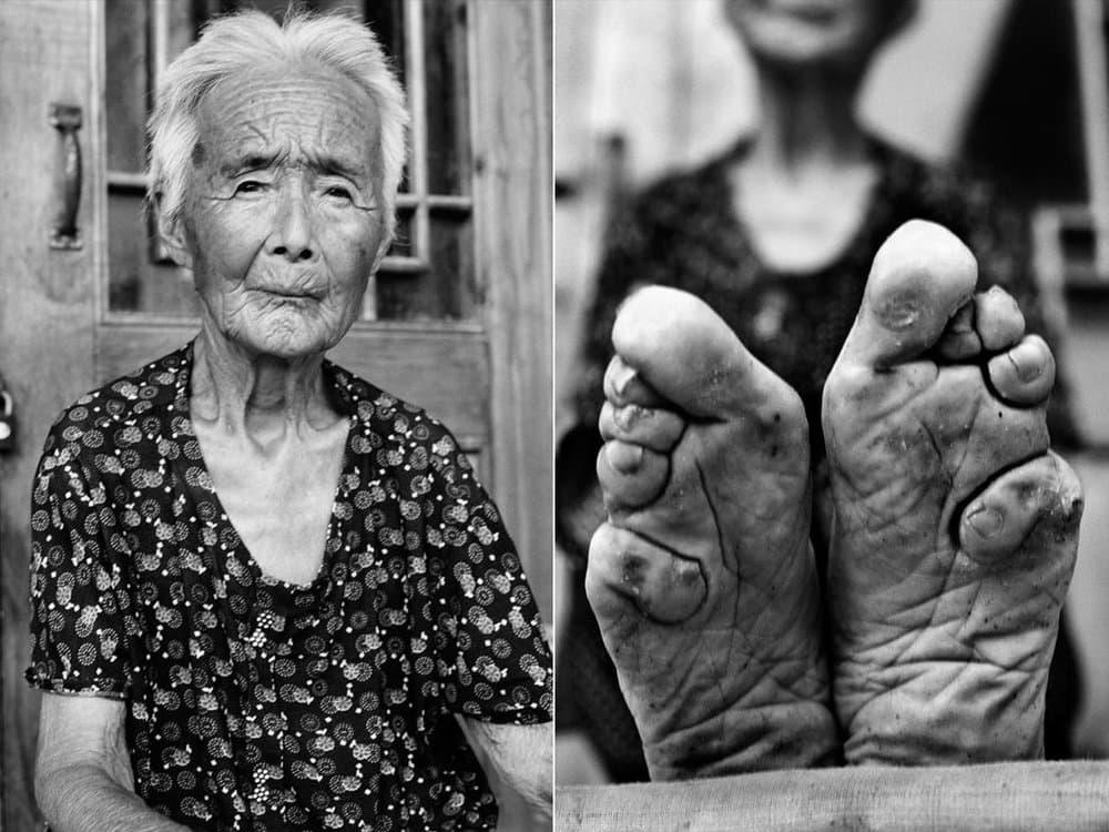 Painful Beauty: The Cruel Foot Binding practice of ancient China