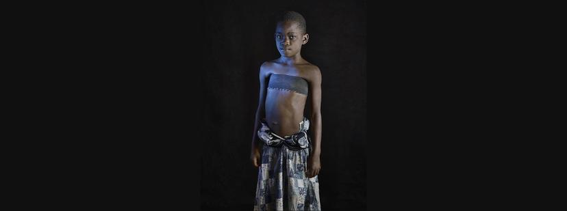 Breast Ironing: A Hidden Global Issue