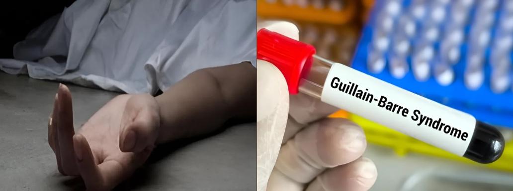 40 years old man dies of Guillain-Barre Syndrome, cases in pune crossed 100