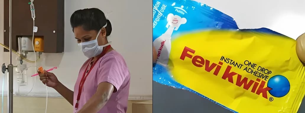 Karnataka Nurse Puts Glue On Boy’s Wound, Shocking Everyone