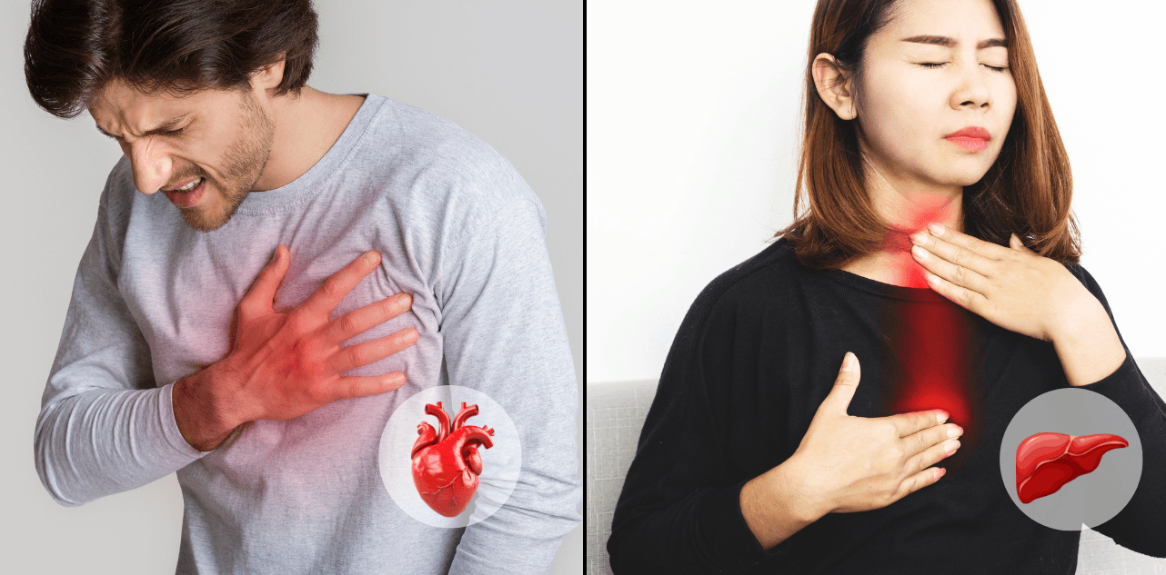 Cardiac Chest Pain Vs. Gastric Chest Pain: How do you Differentiate?